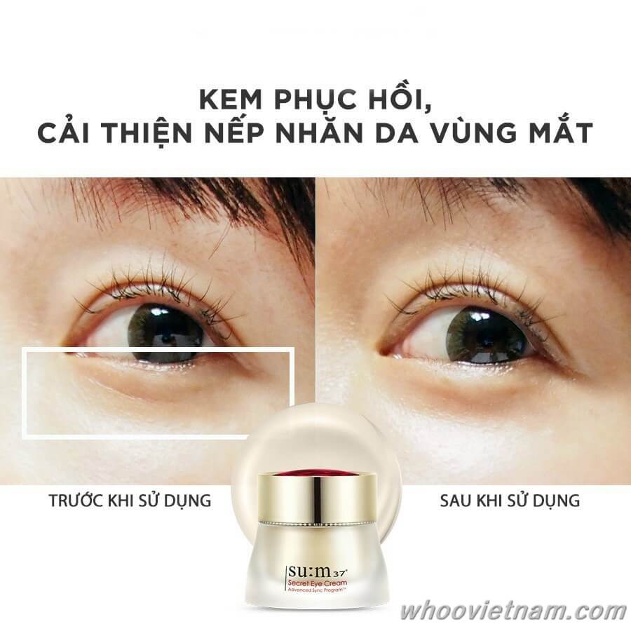 Set Kem dưỡng măt ngăn ngừa lão hóa Su:m37 Secret Eye Cream 25ml